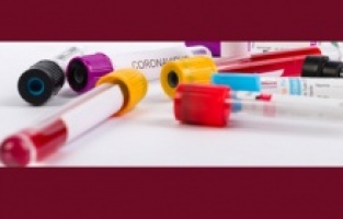 Korona’dan sonra Kawasaki tehdidi